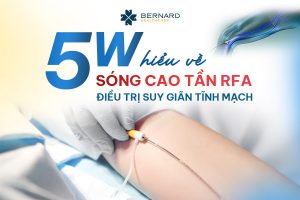 5-dieu-can-biet-ve-RFA-trong-SGTM-min.jpg