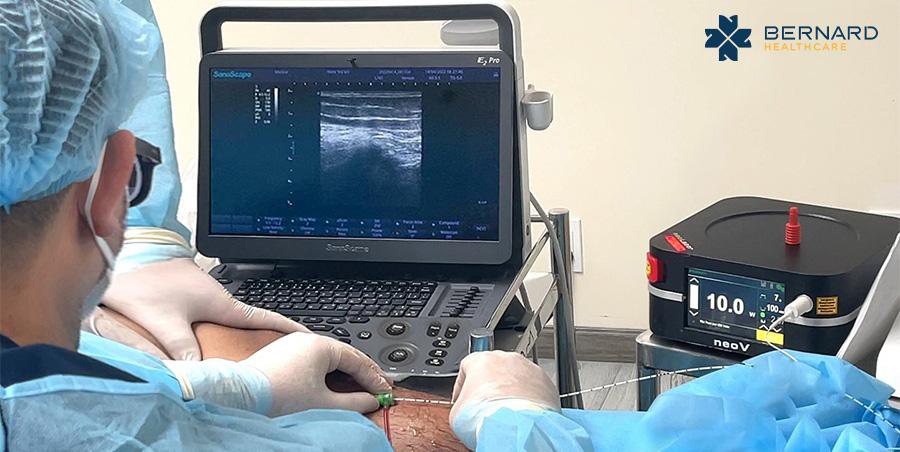 Bác sĩ chuyên khoa phẫu thuật mạch máu trực tiếp điều trị laser nội mạch cho bệnh nhân suy giãn tĩnh mạch tại Bernard Healthcare
