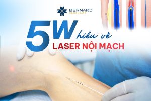 Hieu-ve-laser-noi-mach.jpg