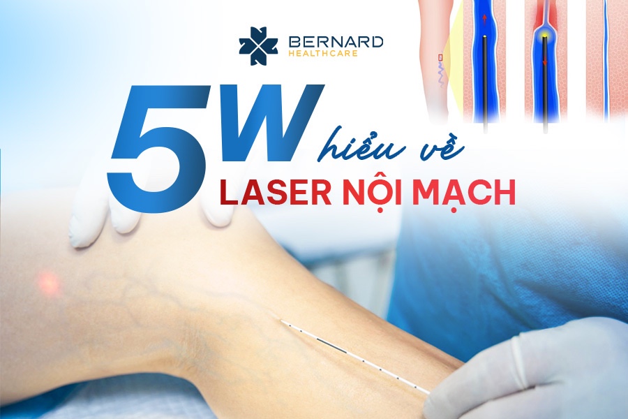 Hieu-ve-laser-noi-mach.jpg