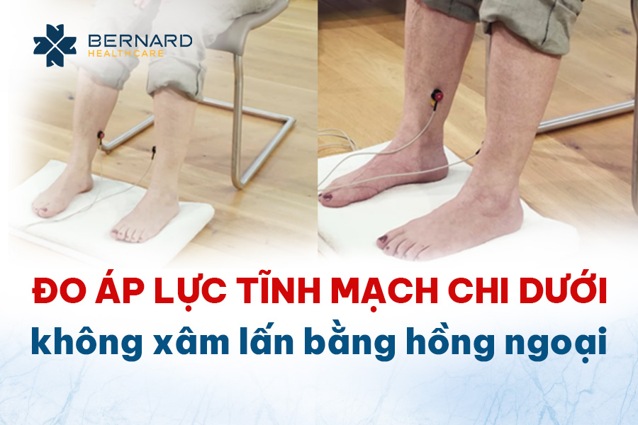 do-ap-luc-tinh-mach-chi-duoi-khong-xam-lan-bang-hong-ngoai