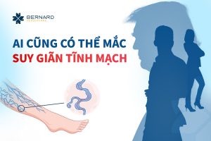 Ai-cung-co-the-mac-suy-gian-tinh-mach.jpg