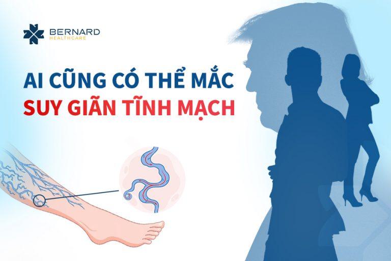 Ai-cung-co-the-mac-suy-gian-tinh-mach.jpg