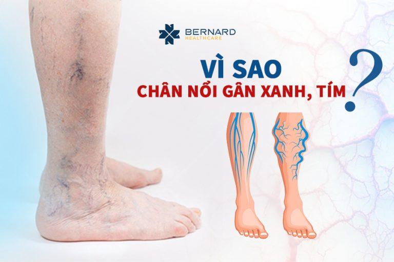 Vi-sao-chan-noi-gan-xanh-tim.jpg