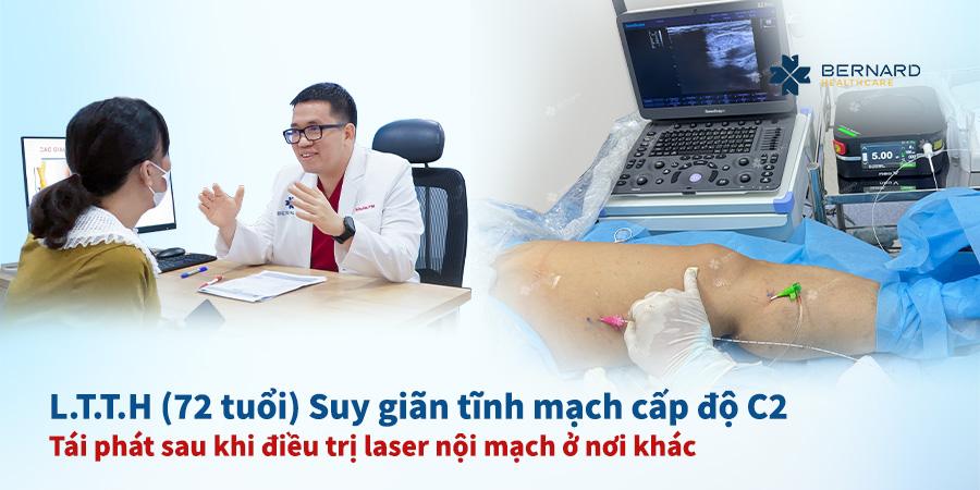 Co-H.-tim-lai-doi-chan-khoe-manh-sau-2-lan-thuc-hien-laser-noi-mach-o-co-so-khac.jpg