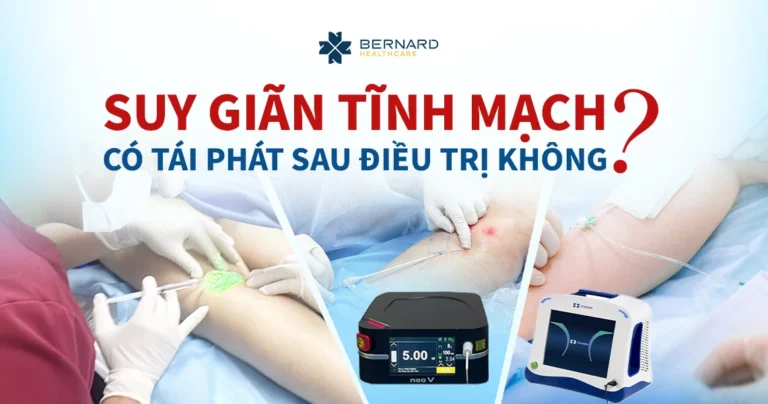suy-gian-tinh-mach-co-tai-phat-khong