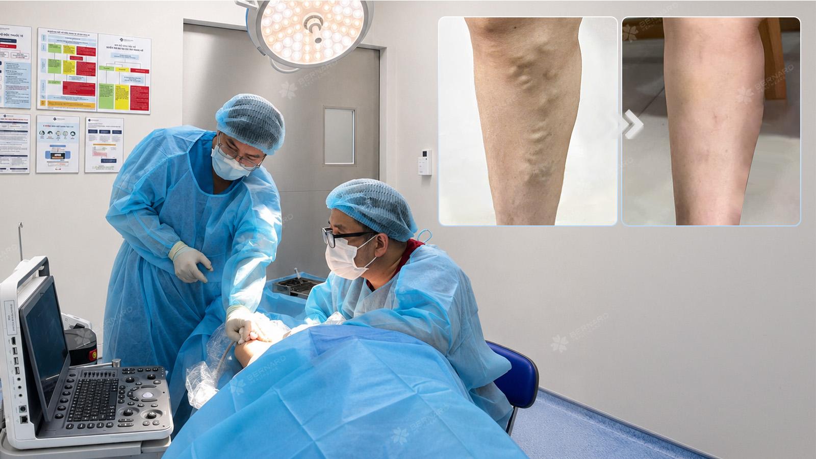 Nhiều bệnh nhân lựa chọn điều trị suy giãn tĩnh mạch bằng công nghệ cao laser 1940nm tại Bernard Healthcare